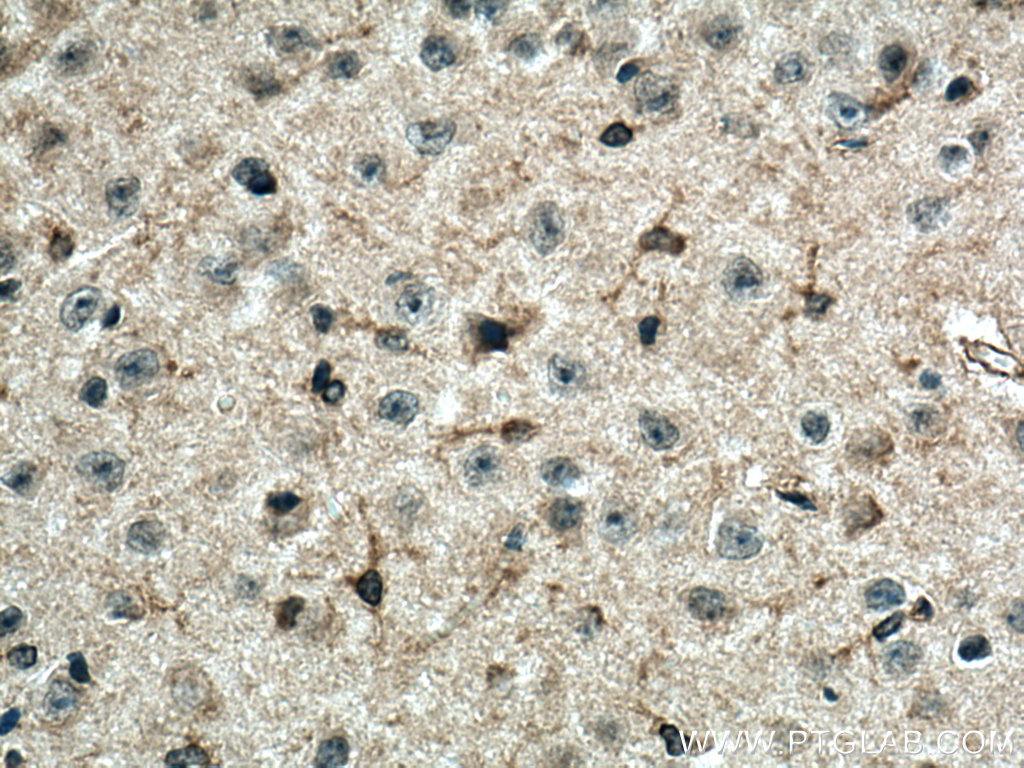 IHC staining of mouse brain using 18370-1-AP