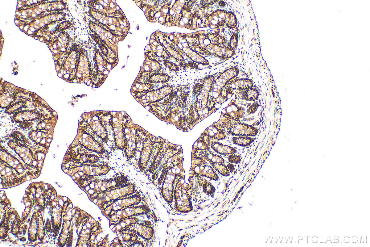 IHC staining of mouse colon using 10197-1-AP