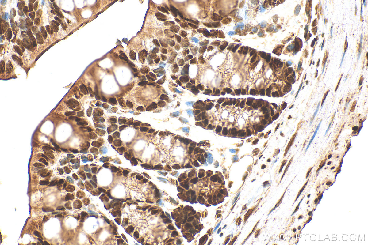 IHC staining of mouse colon using 10197-1-AP