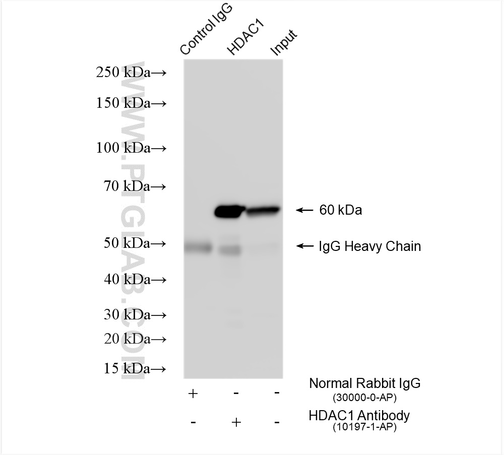 IP experiment of HeLa using 10197-1-AP