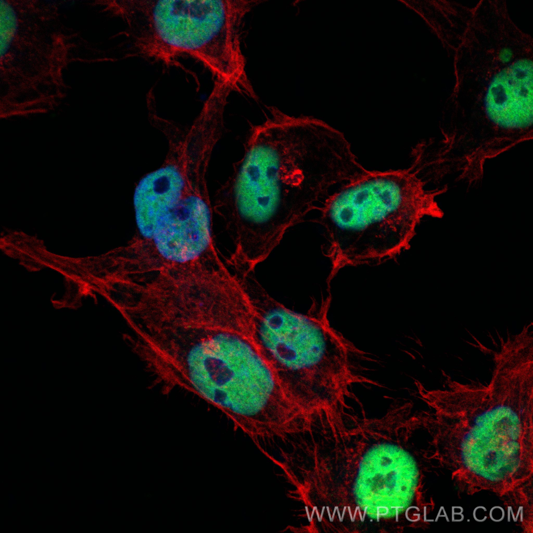 IF Staining of A431 using CL488-66085