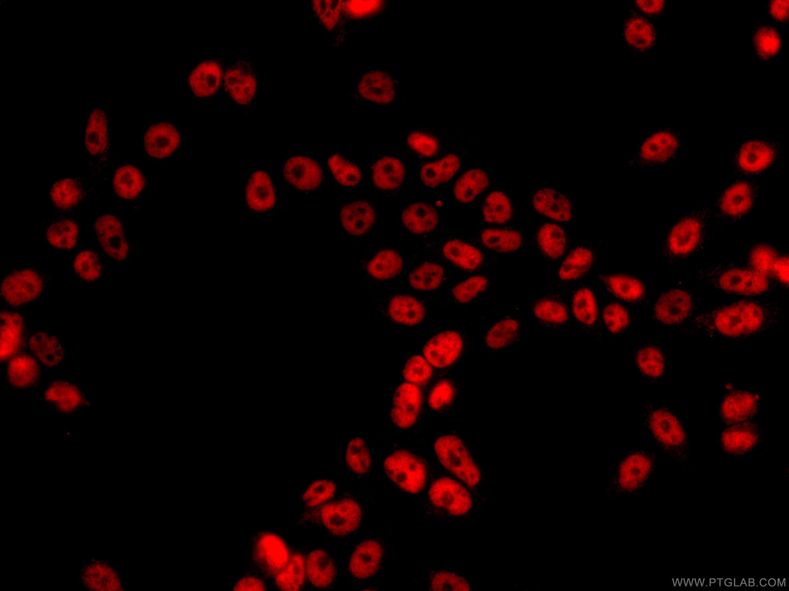 IF Staining of HeLa using CL594-66085