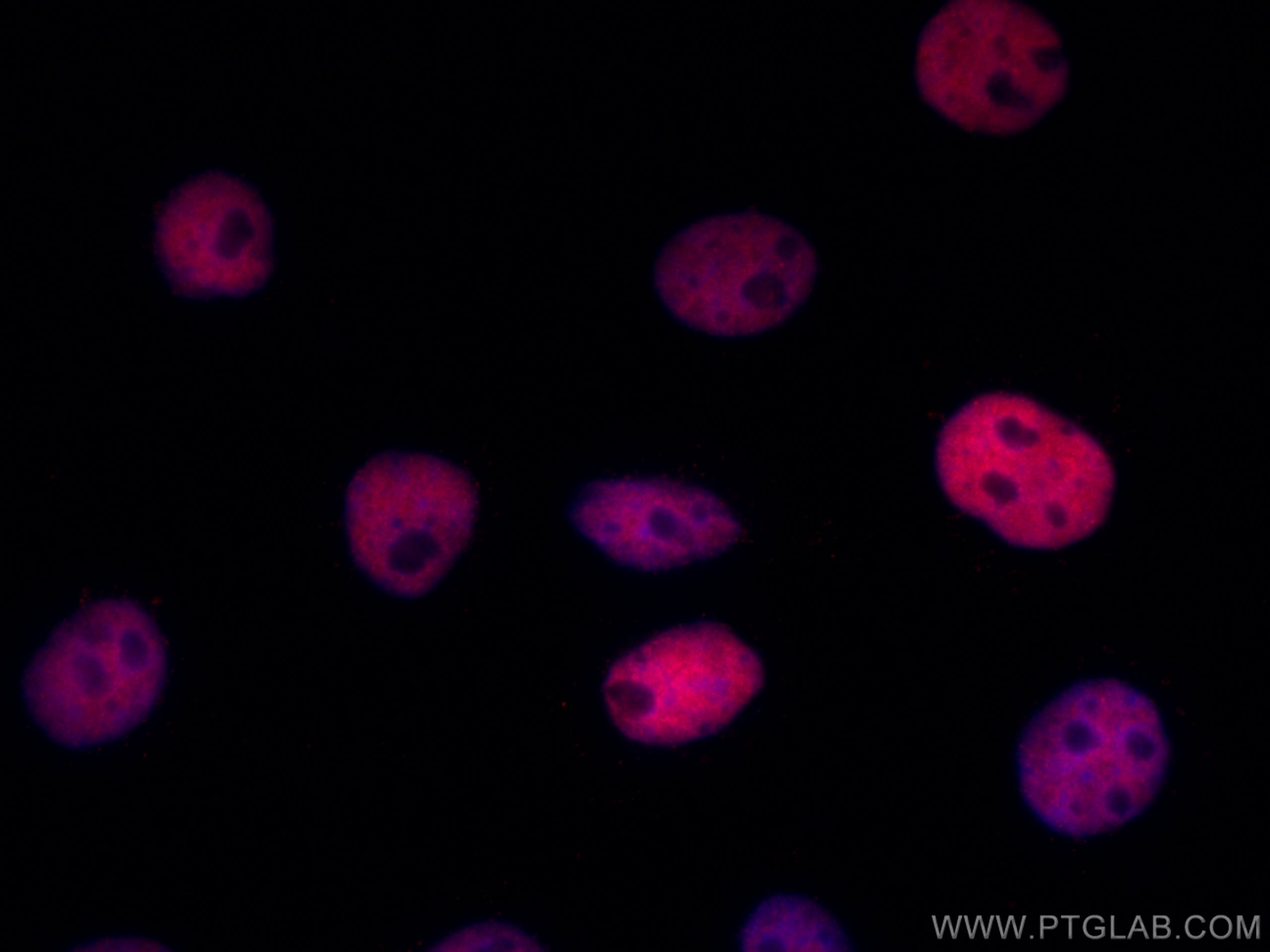 IF Staining of A431 using CL594-66085