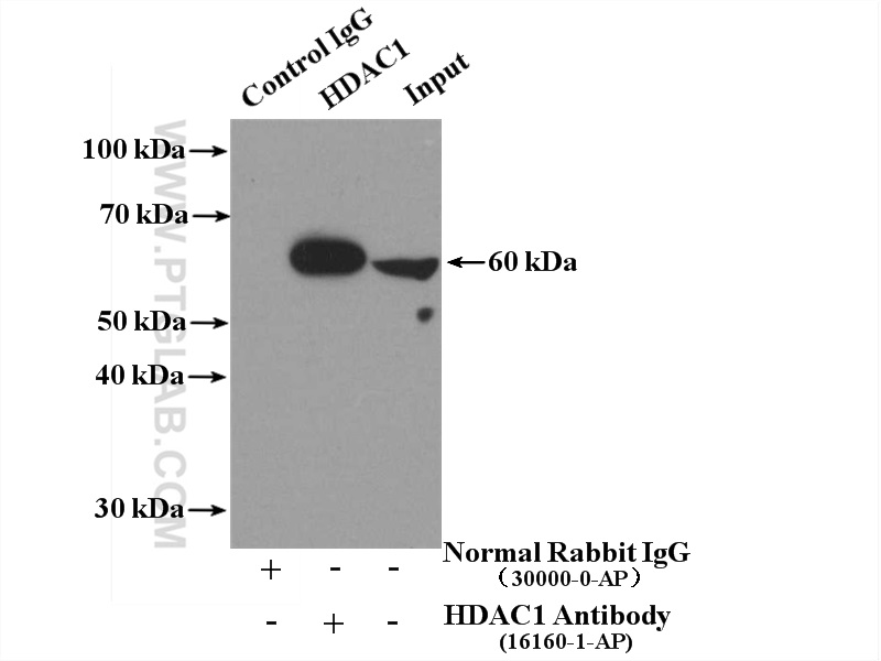 IP experiment of mouse testis using 16160-1-AP