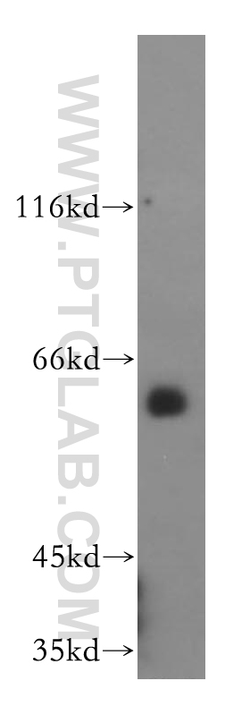 HDAC1-specific