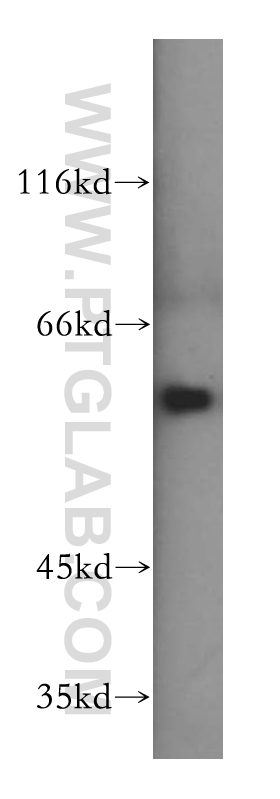 WB analysis of mouse testis using 16160-1-AP