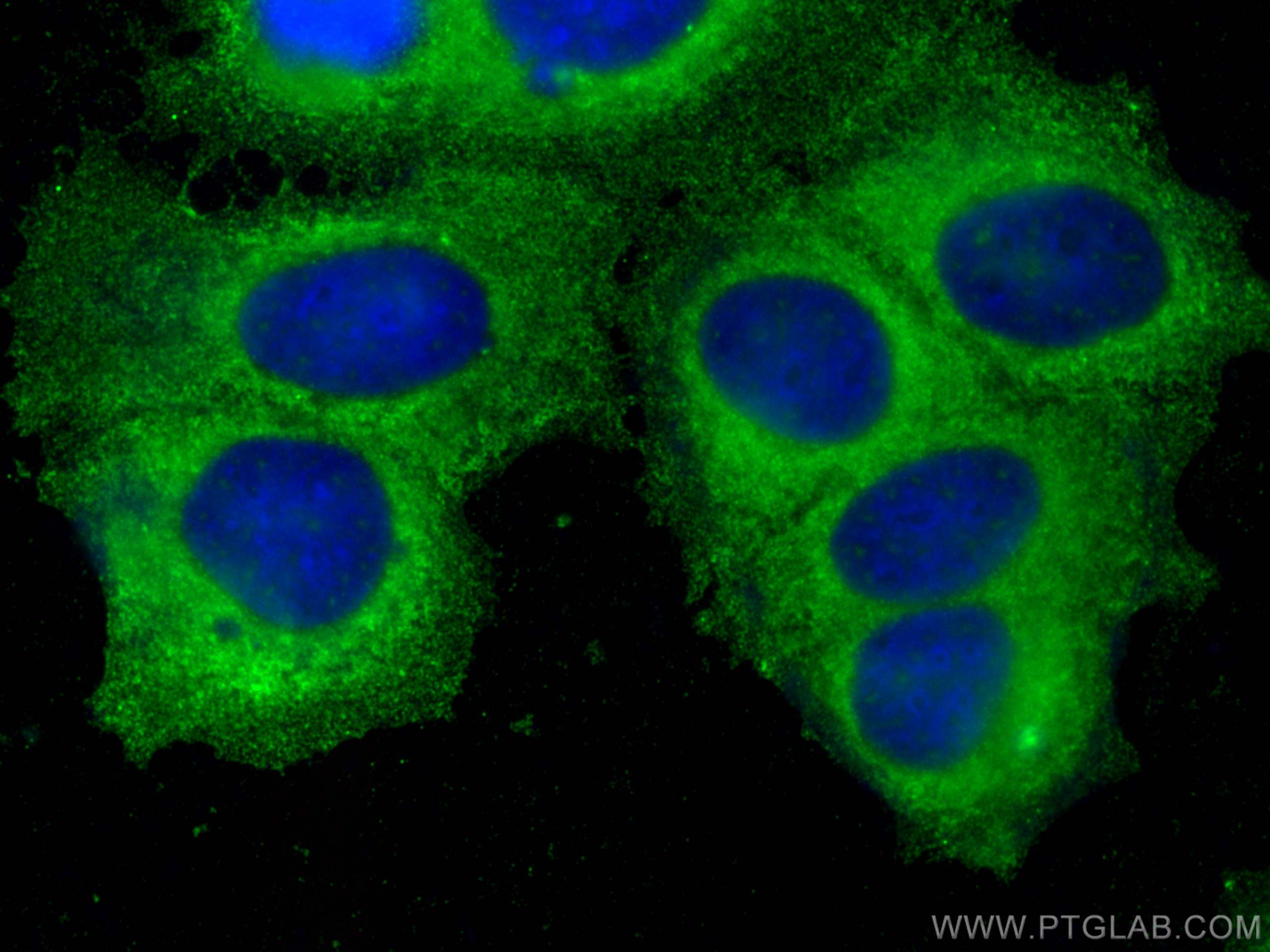 IF Staining of MCF-7 using 67646-1-Ig (same clone as 67646-1-PBS)