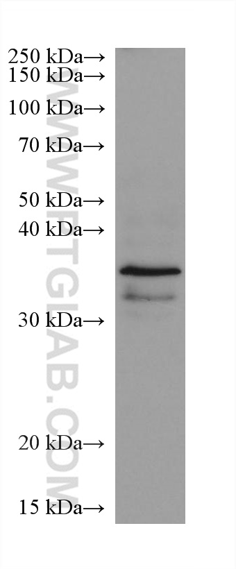 HDAC11