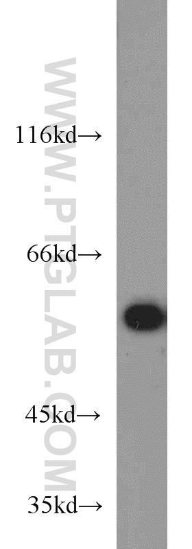 HDAC2 Polyclonal antibody