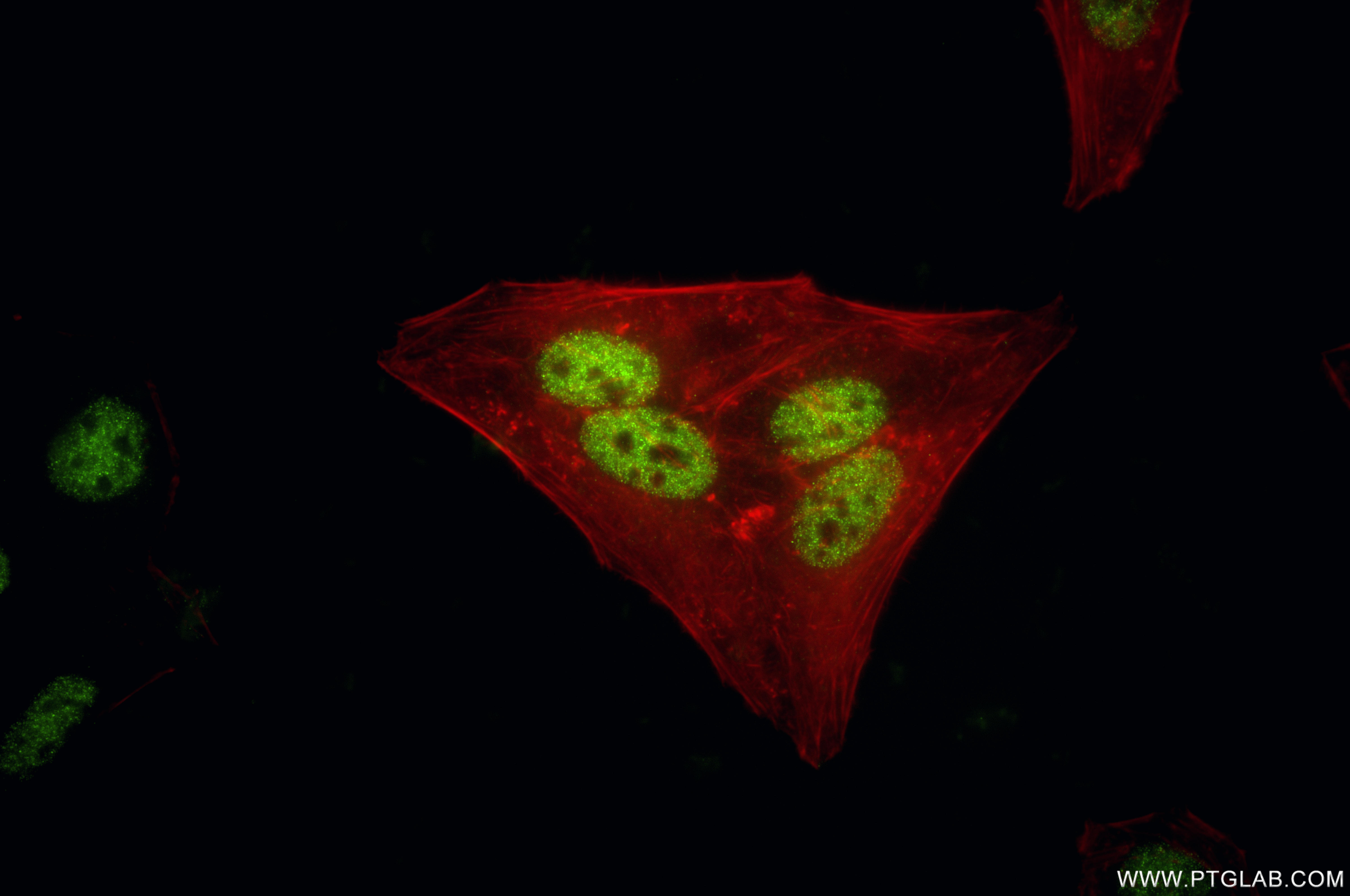 IF Staining of HepG2 using 81497-4-RR (same clone as 81497-4-PBS) IF Staining of HepG2 using 81497-4-RR (same clone as 81497-4-PBS)