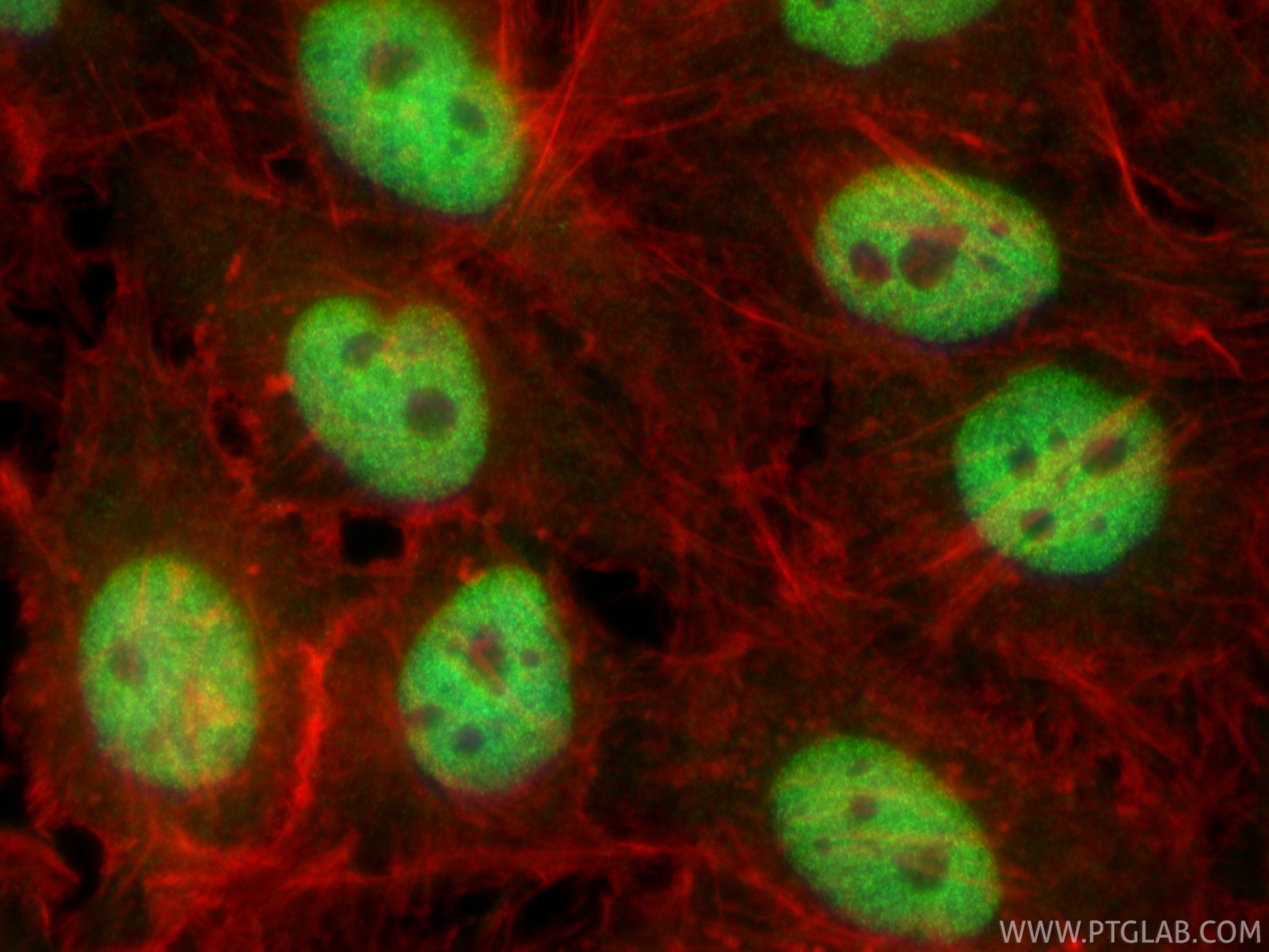IF Staining of HeLa using 81497-4-RR (same clone as 81497-4-PBS) IF Staining of HeLa using 81497-4-RR (same clone as 81497-4-PBS)