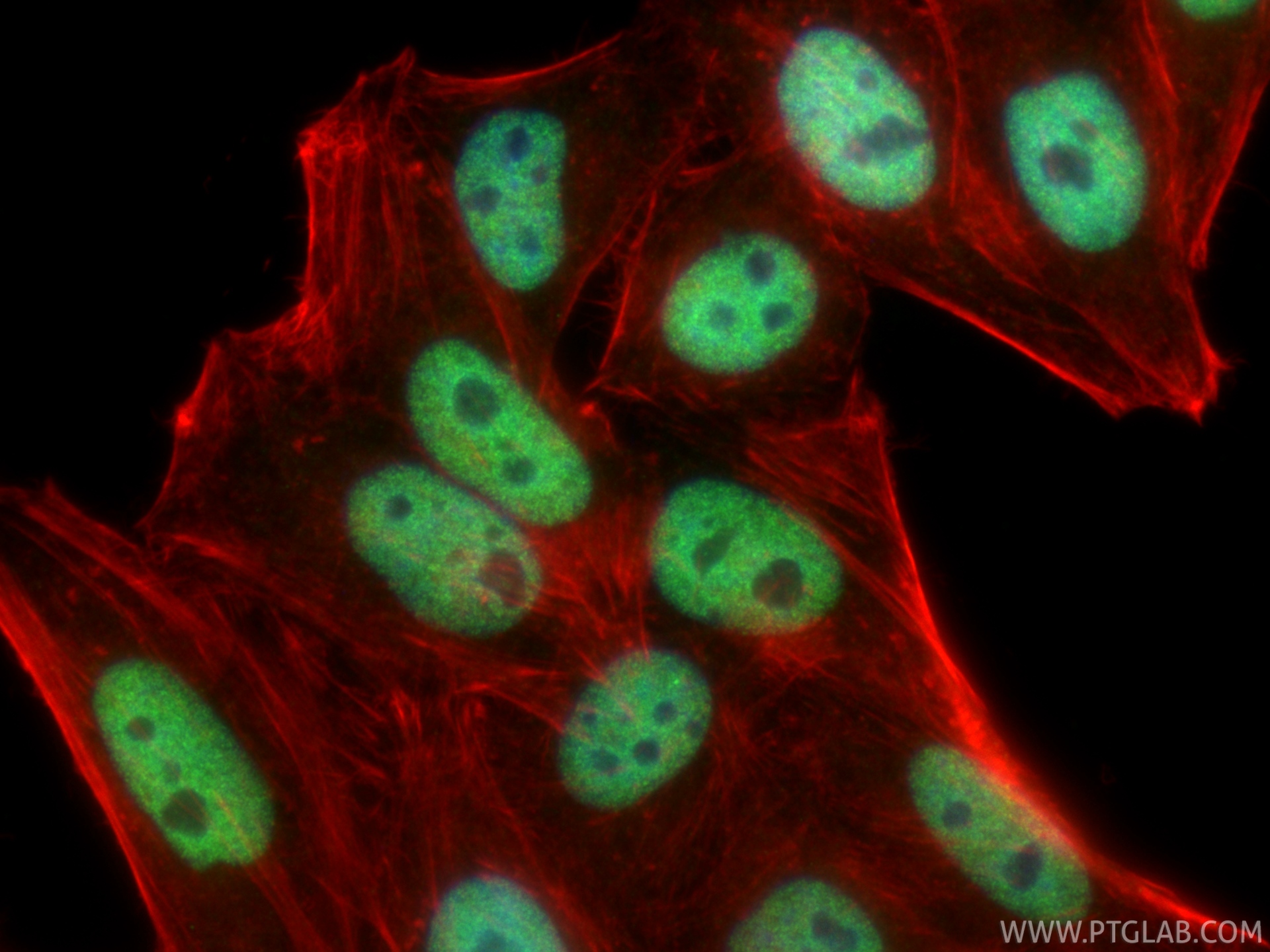 IF Staining of HepG2 using 81497-4-RR (same clone as 81497-4-PBS) IF Staining of HepG2 using 81497-4-RR (same clone as 81497-4-PBS)