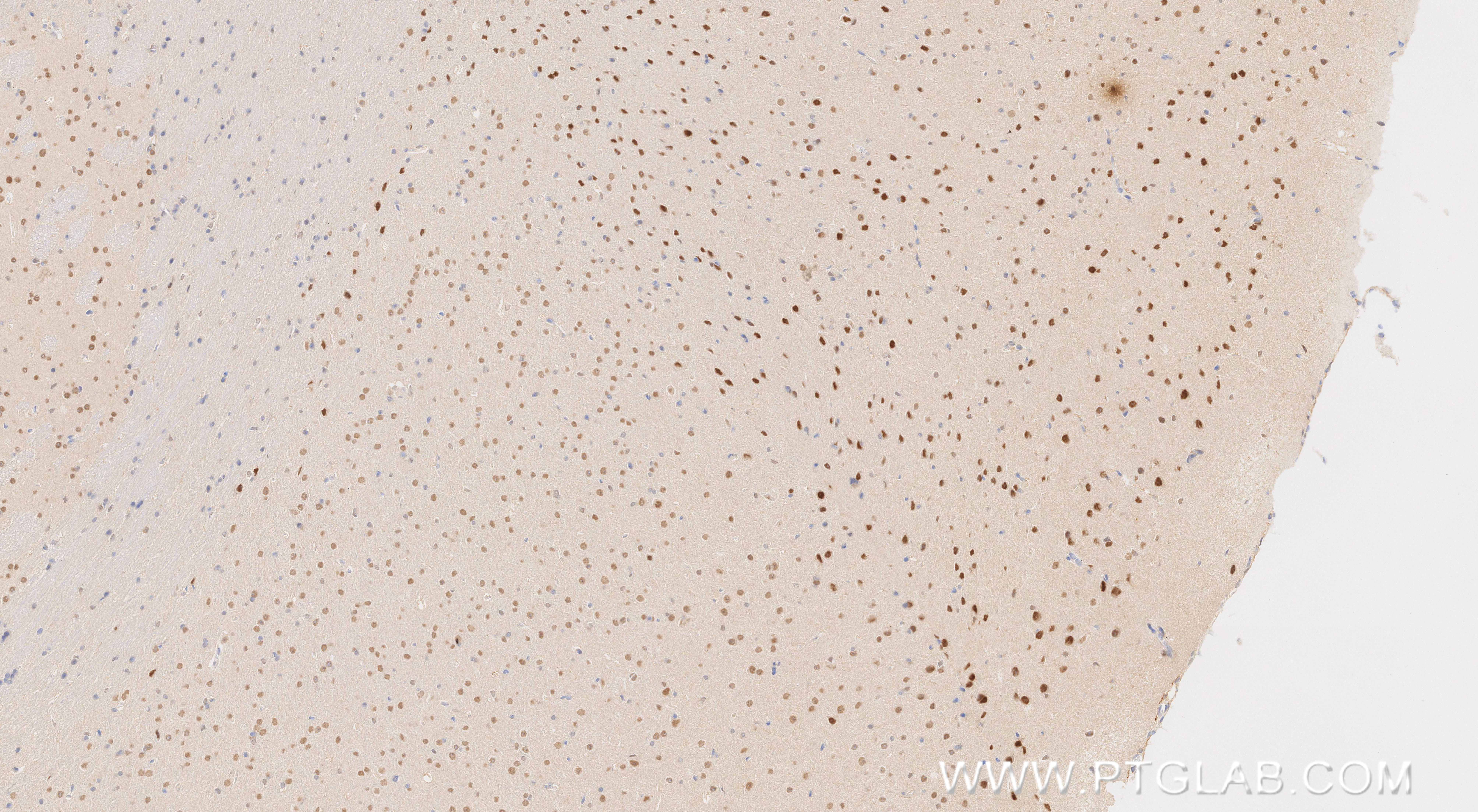 IHC staining of mouse brain using 81497-4-RR (same clone as 81497-4-PBS) IHC staining of mouse brain using 81497-4-RR (same clone as 81497-4-PBS)