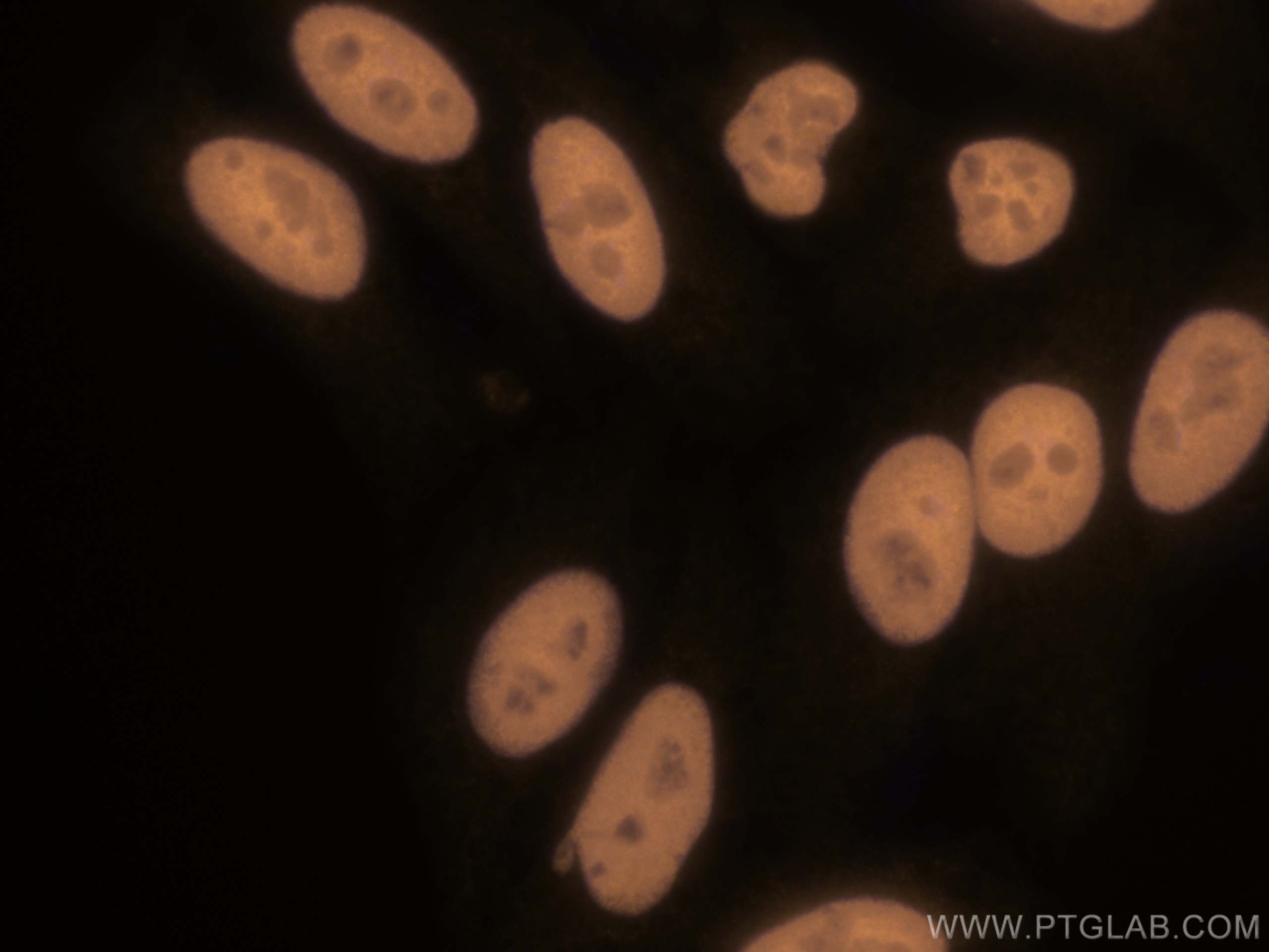 IF Staining of HepG2 using CL555-12922