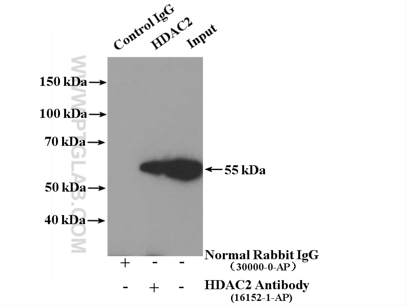 IP experiment of A431 using 16152-1-AP