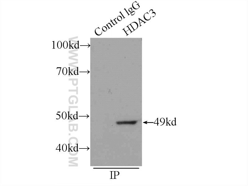 IP experiment of A431 using 10255-1-AP