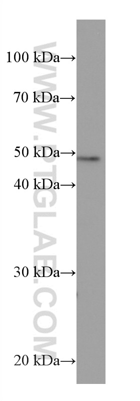 HDAC3