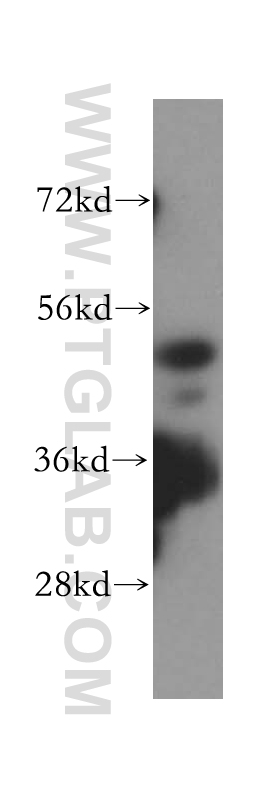 HDAC3-specific