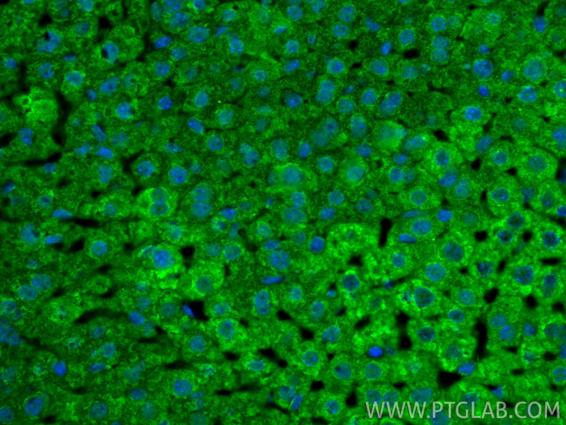 IF Staining of mouse liver using 17449-1-AP