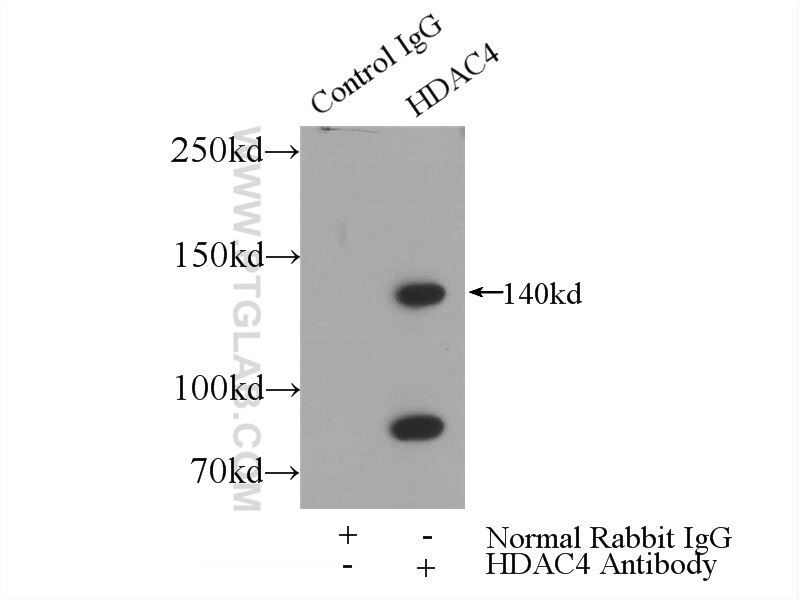 IP experiment of HeLa using 17449-1-AP