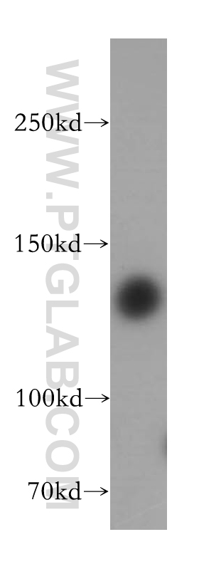 HDAC4 Polyclonal antibody