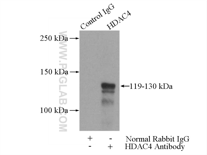 IP experiment of HeLa using 16165-1-AP