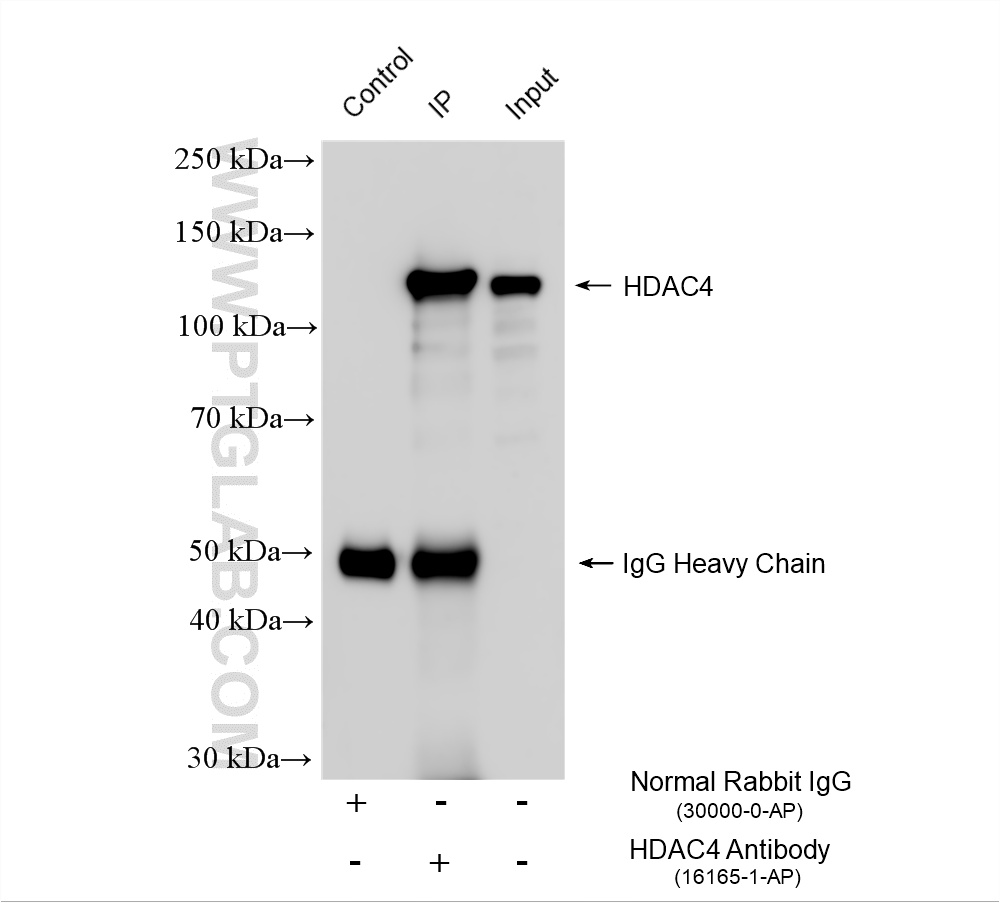 IP experiment of HeLa using 16165-1-AP IP experiment of HeLa using 16165-1-AP