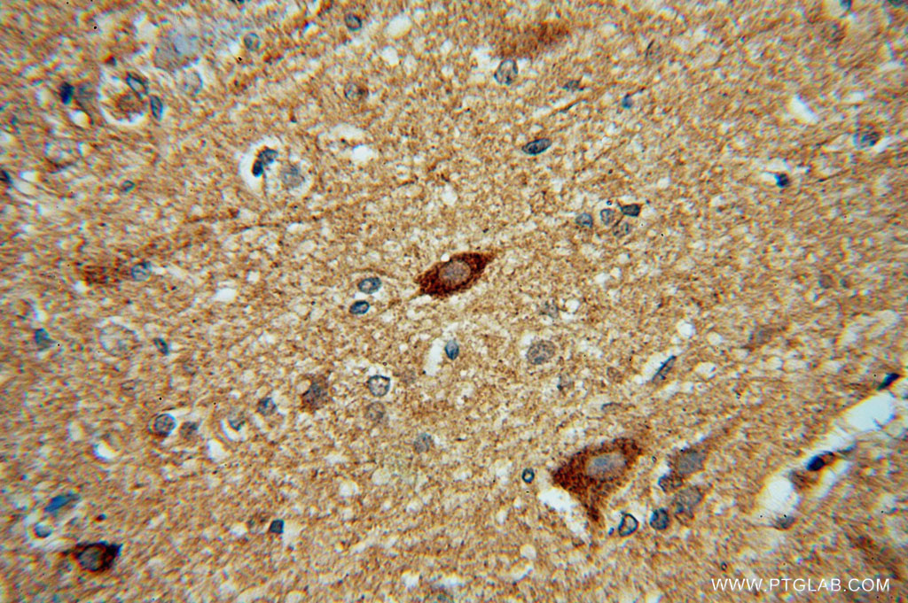 IHC staining of human brain using 16166-1-AP