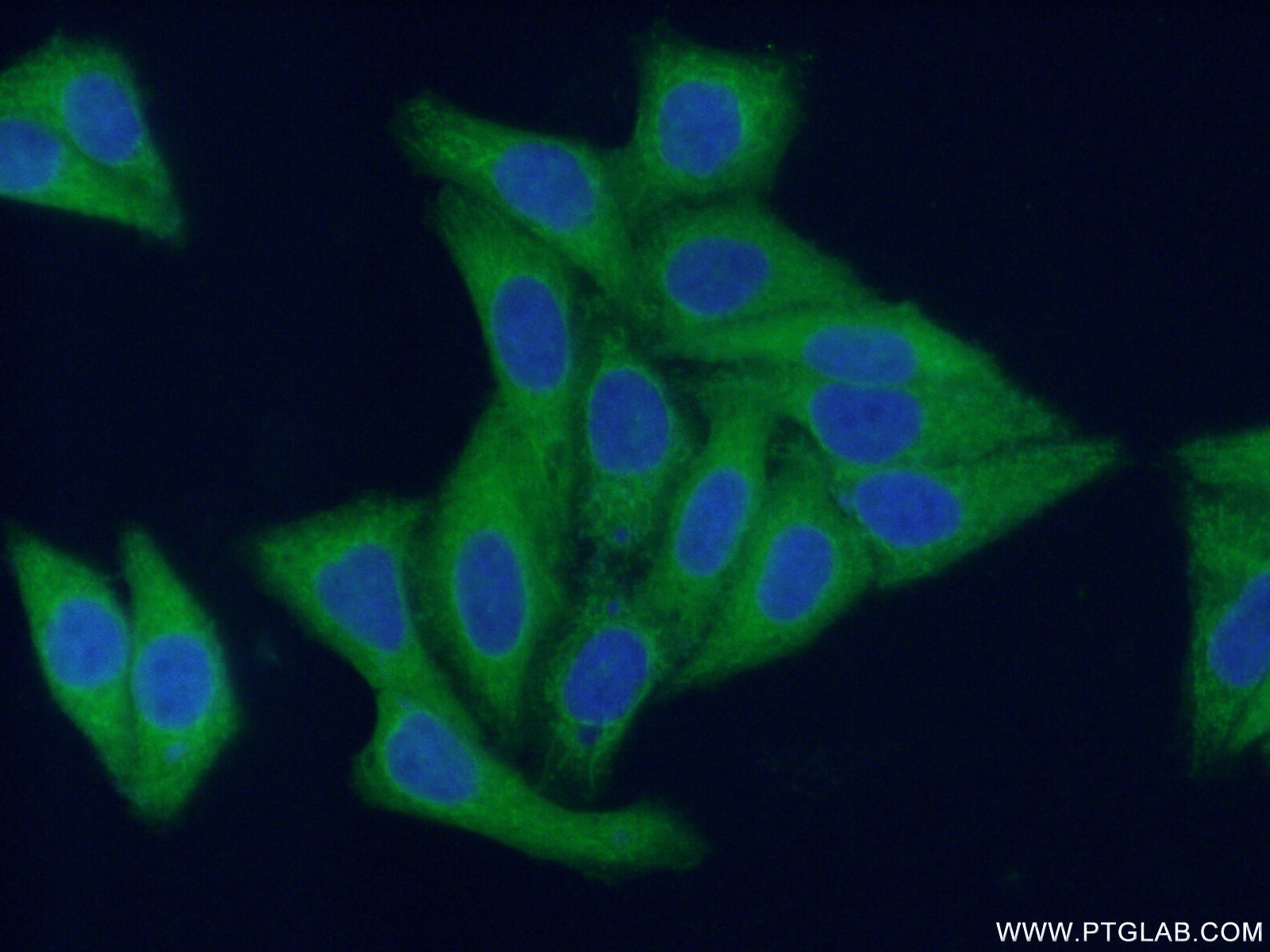 IF Staining of HepG2 using 12834-1-AP