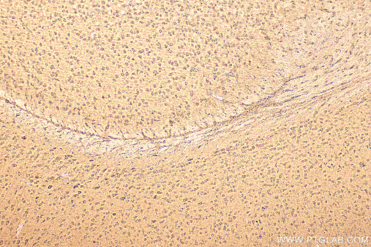 IHC staining of mouse brain using 12834-1-AP