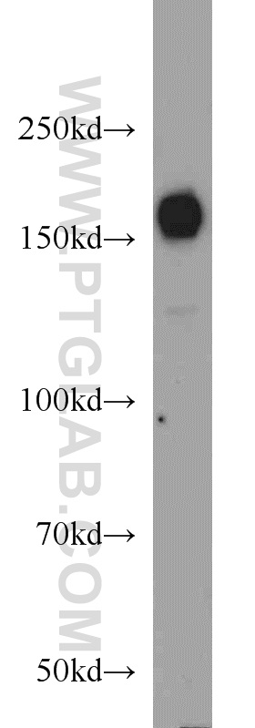 HDAC6 Polyclonal antibody