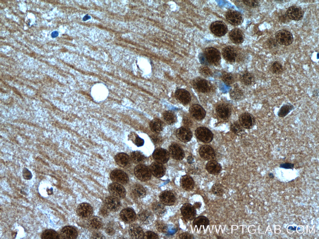 IHC staining of mouse brain using 16167-1-AP