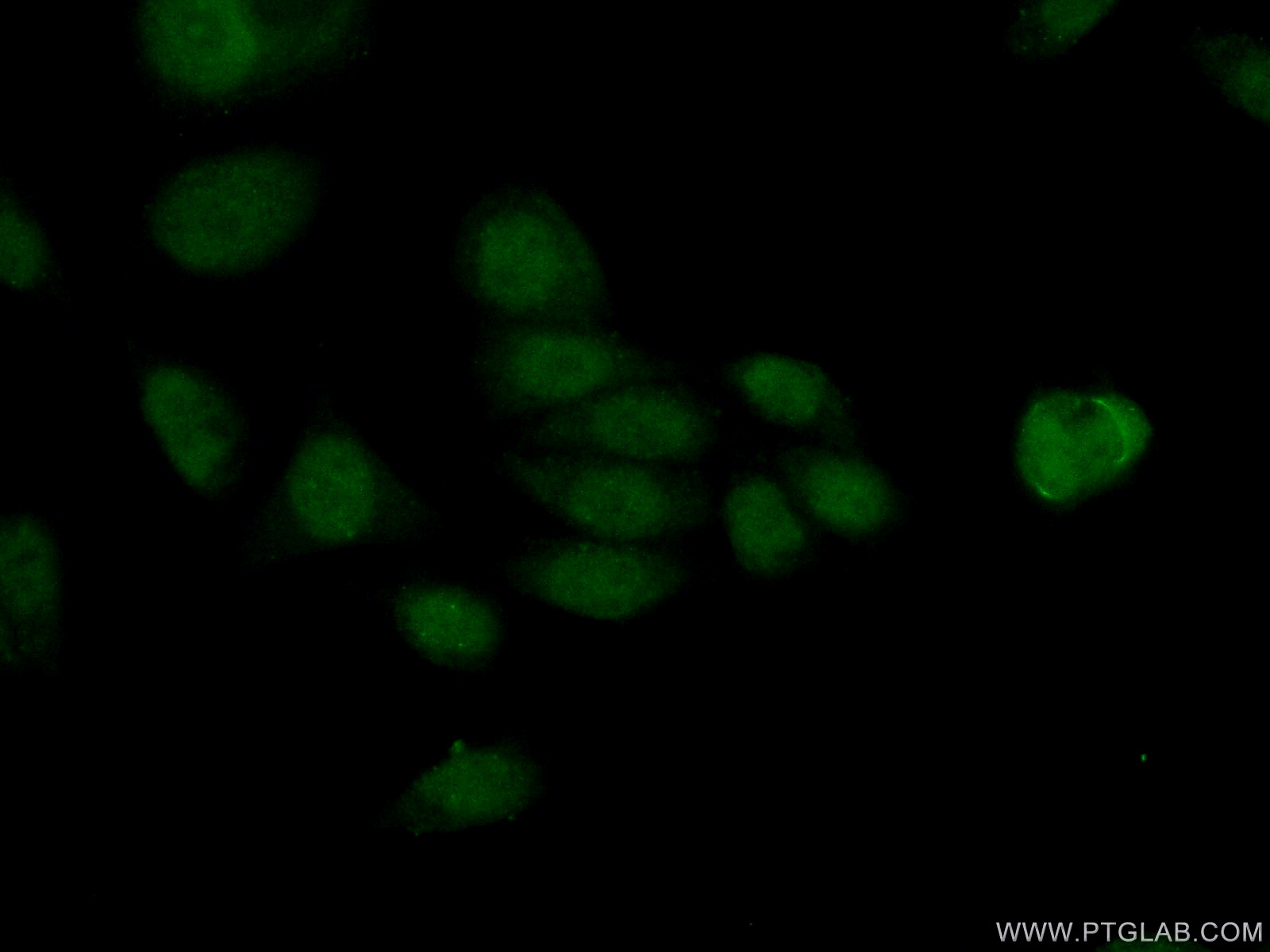 IF Staining of HeLa using 17548-1-AP