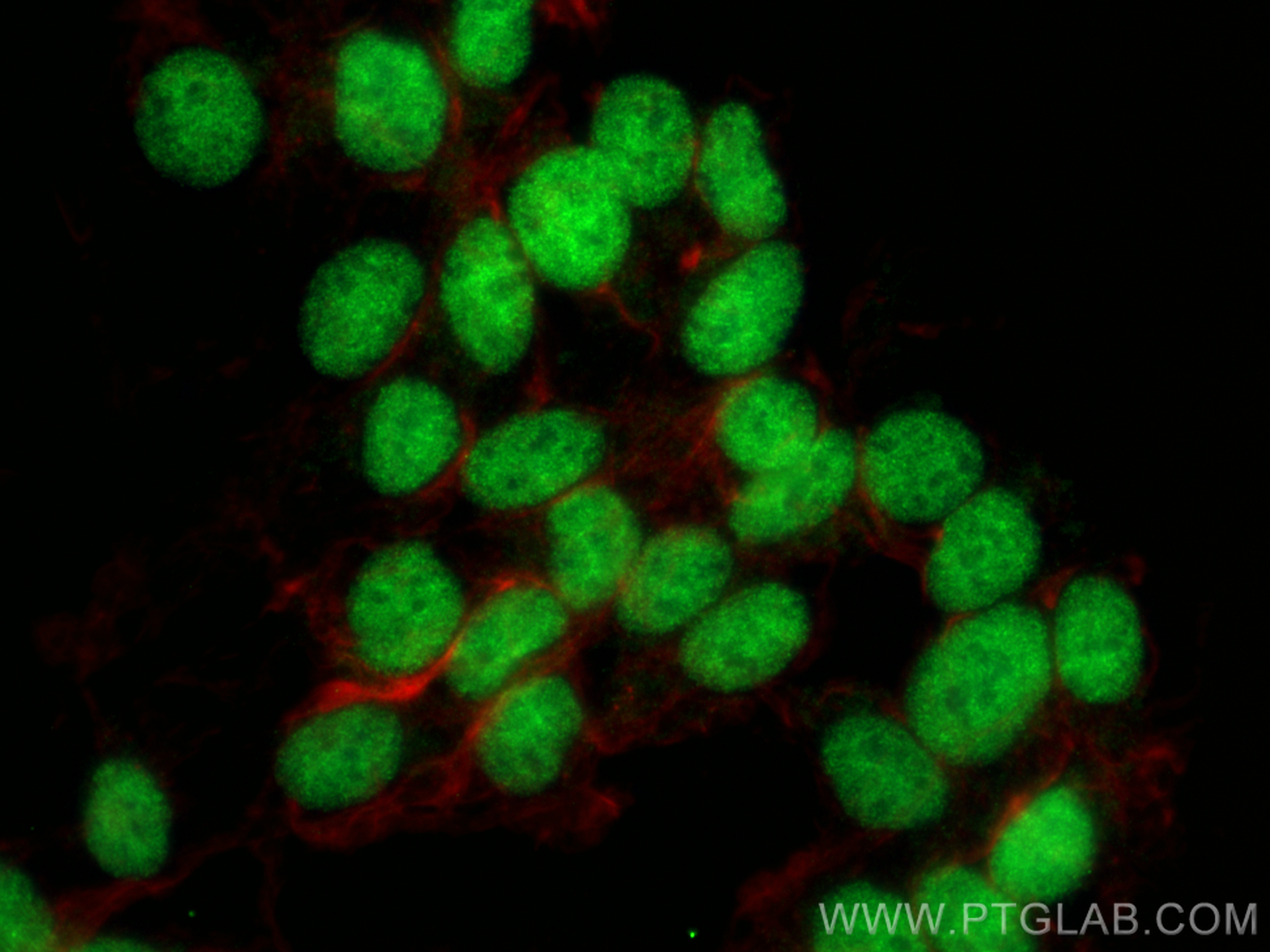 IF Staining of SH-SY5Y using 23328-1-AP