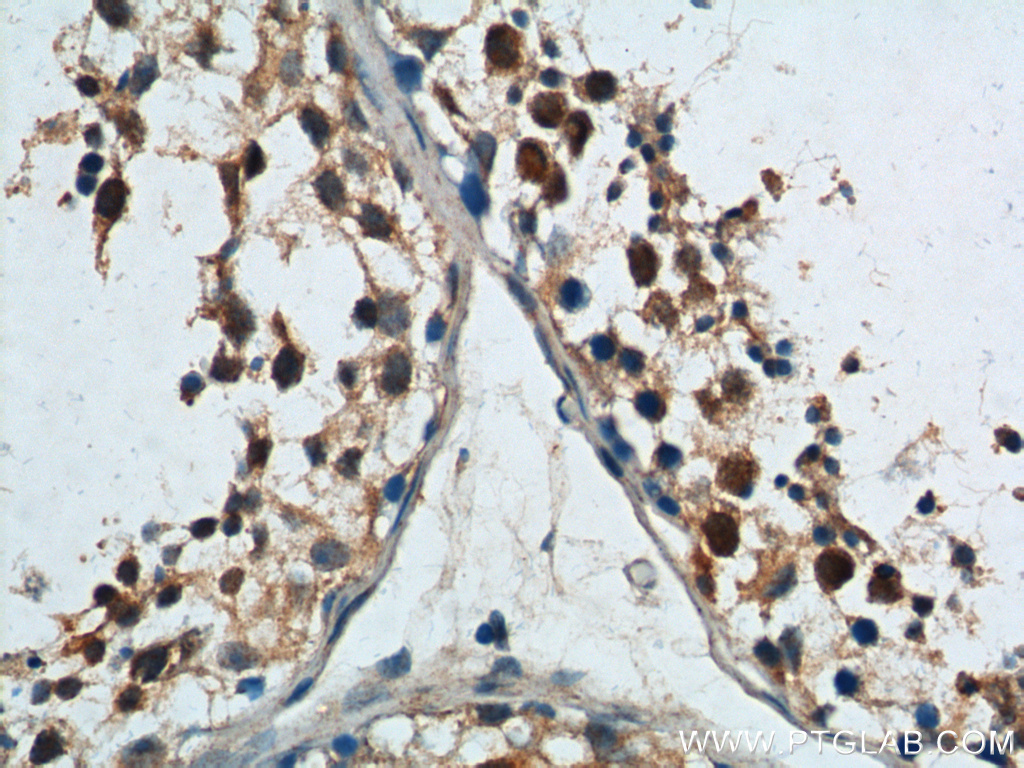 IHC staining of human testis using 23328-1-AP