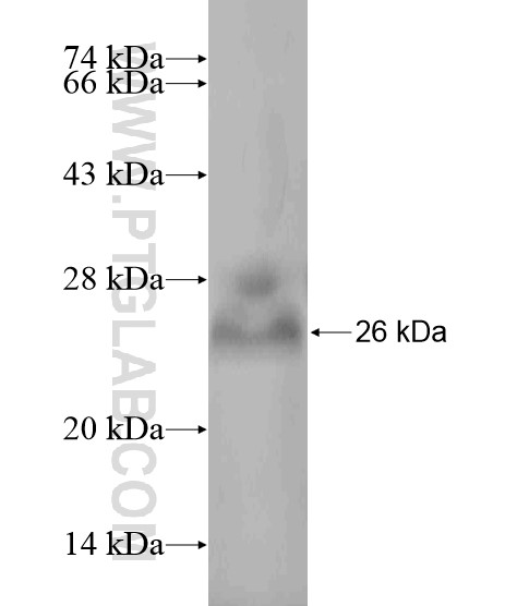 HDAC9 fusion protein Ag19947 SDS-PAGE HDAC9 fusion protein Ag19947 SDS-PAGE
