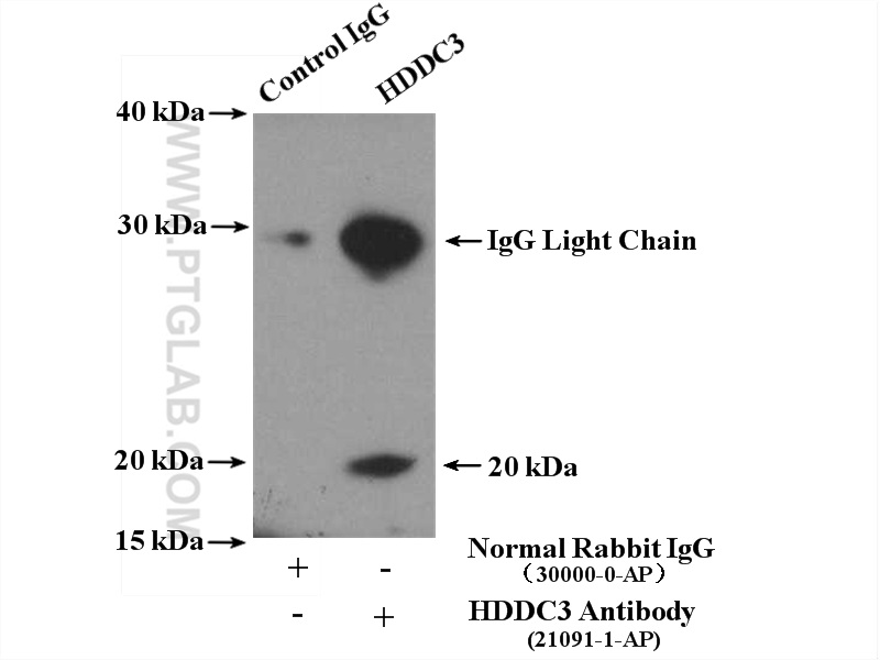 IP experiment of HeLa using 21091-1-AP