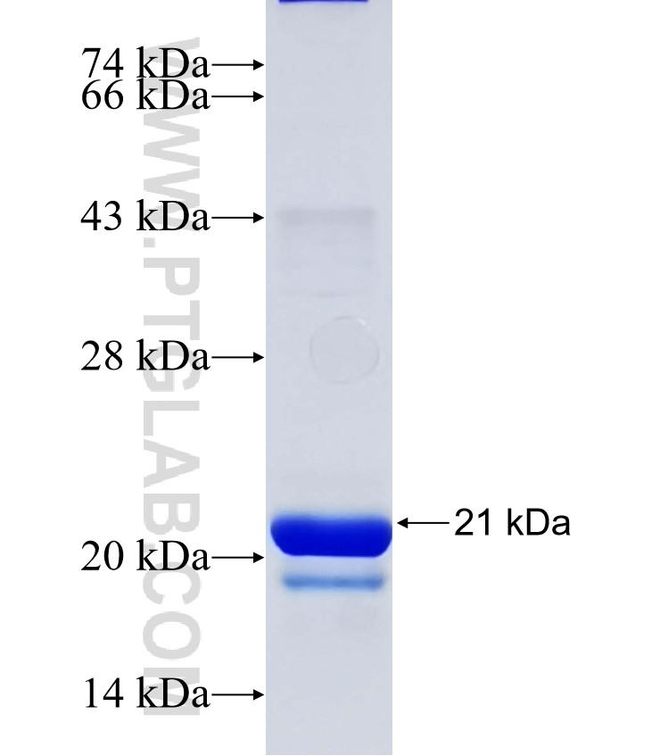 HDDC3 fusion protein Ag15483 SDS-PAGE HDDC3 fusion protein Ag15483 SDS-PAGE