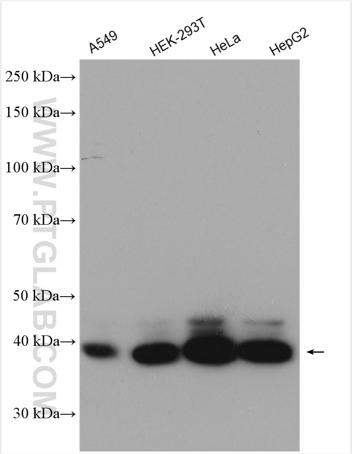 WB analysis using 11344-1-AP