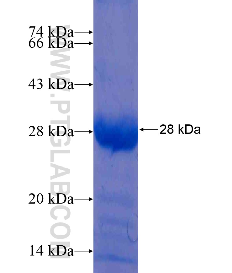 HDGF fusion protein Ag17090 SDS-PAGE