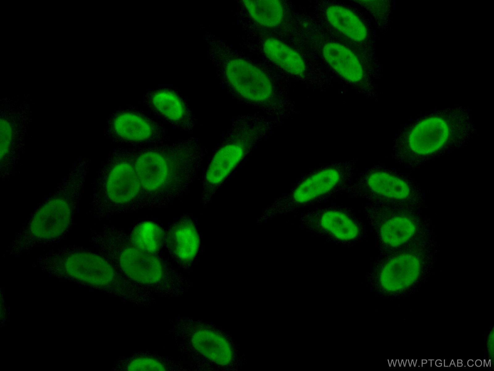 IF Staining of HepG2 using 15134-1-AP