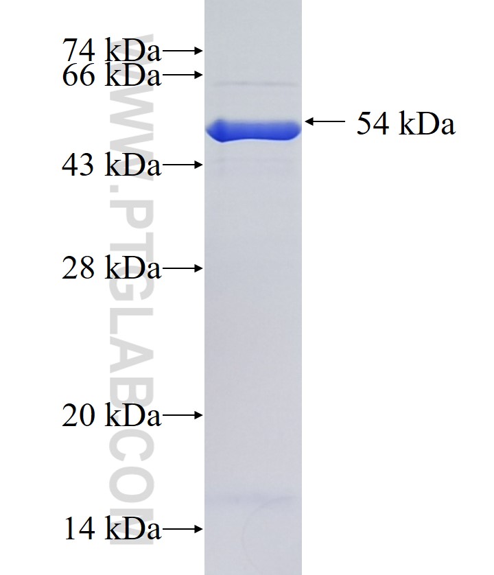 HDGFL1 fusion protein Ag36944 SDS-PAGE