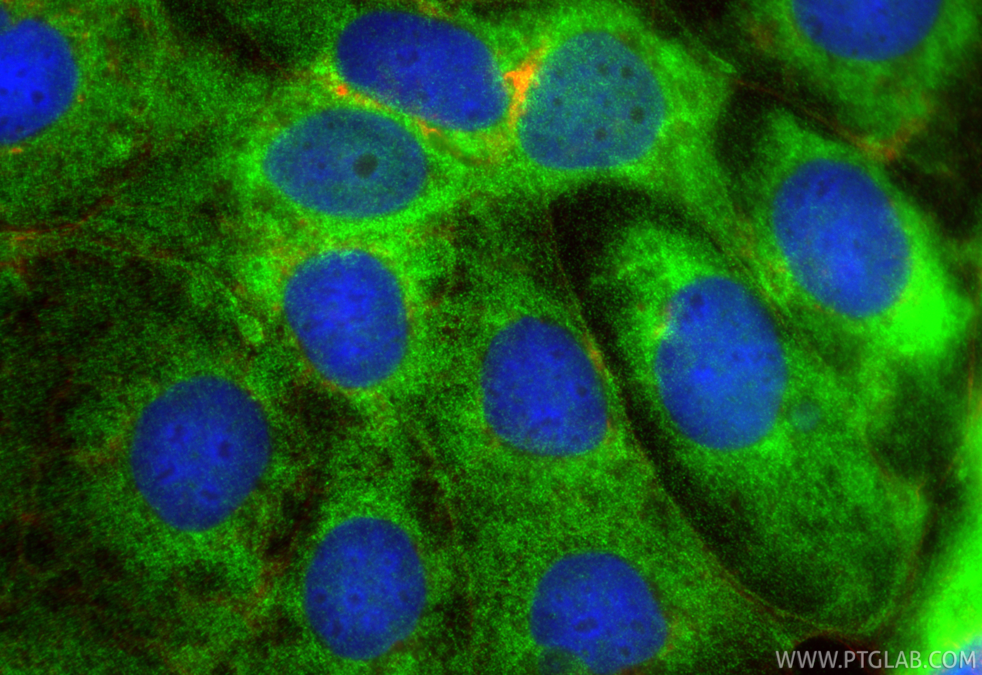 Immunofluorescent analysis of (-20°C Ethanol) fixed Caco-2 cells using HDHD1A antibody (33953-1-AP) at dilution of 1:400 and CoraLite®488-Conjugated Goat Anti-Rabbit IgG(H+L) (<a class='green' href='/productredirect?CatalogNo=SA00013-2' target='_blank'>SA00013-2</a>), CL594-Phalloidin (red). IF Staining of Caco-2 using 33953-1-AP
