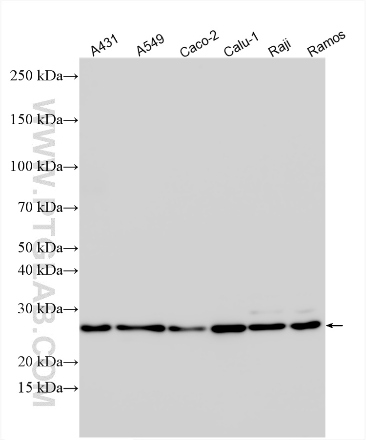Various lysates were subjected to SDS PAGE followed by western blot with 33953-1-AP (HDHD1A antibody) at dilution of 1:4000 incubated at room temperature for 1.5 hours. WB analysis using 33953-1-AP