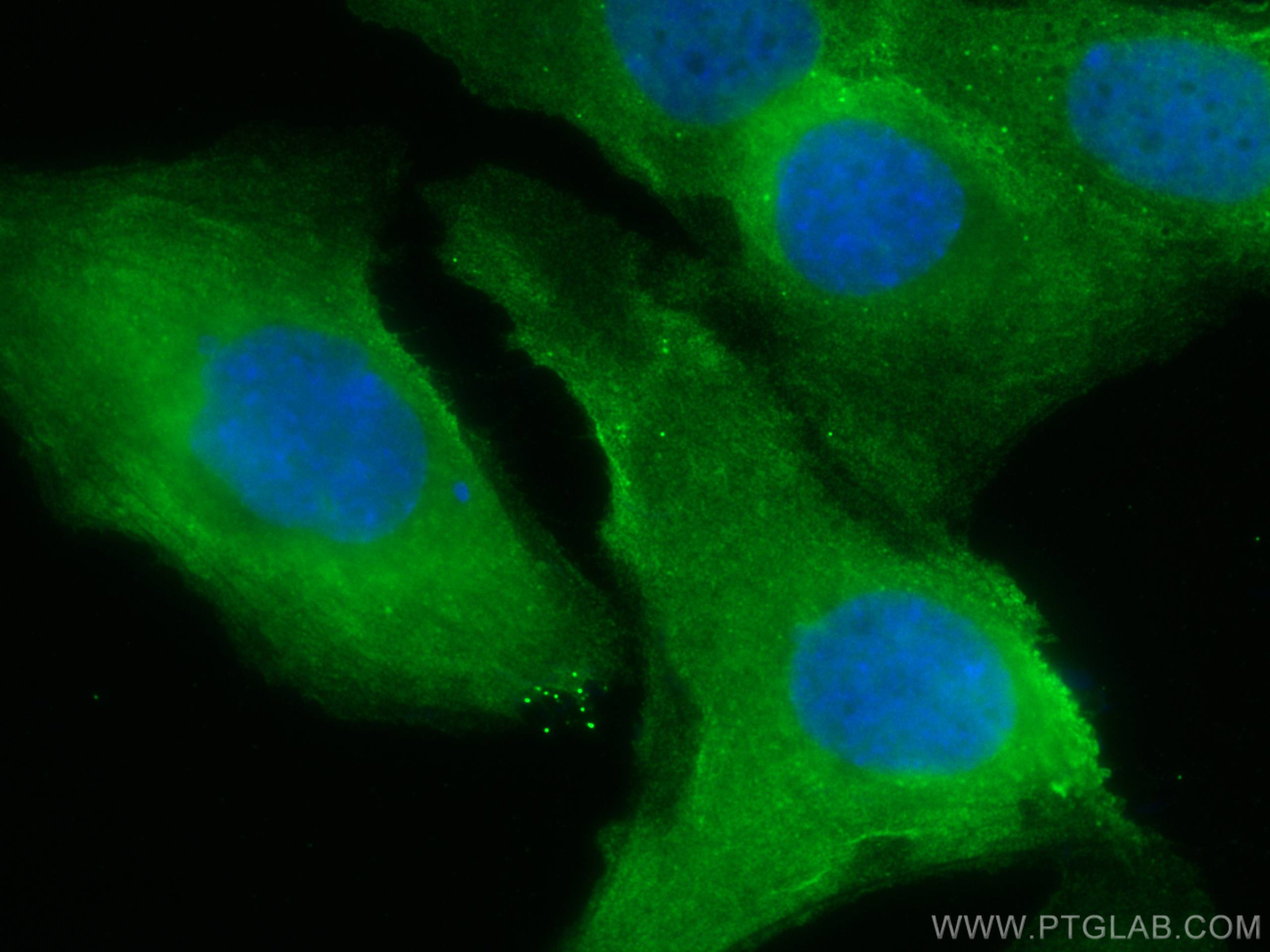 IF Staining of SKOV-3 using CL488-66557