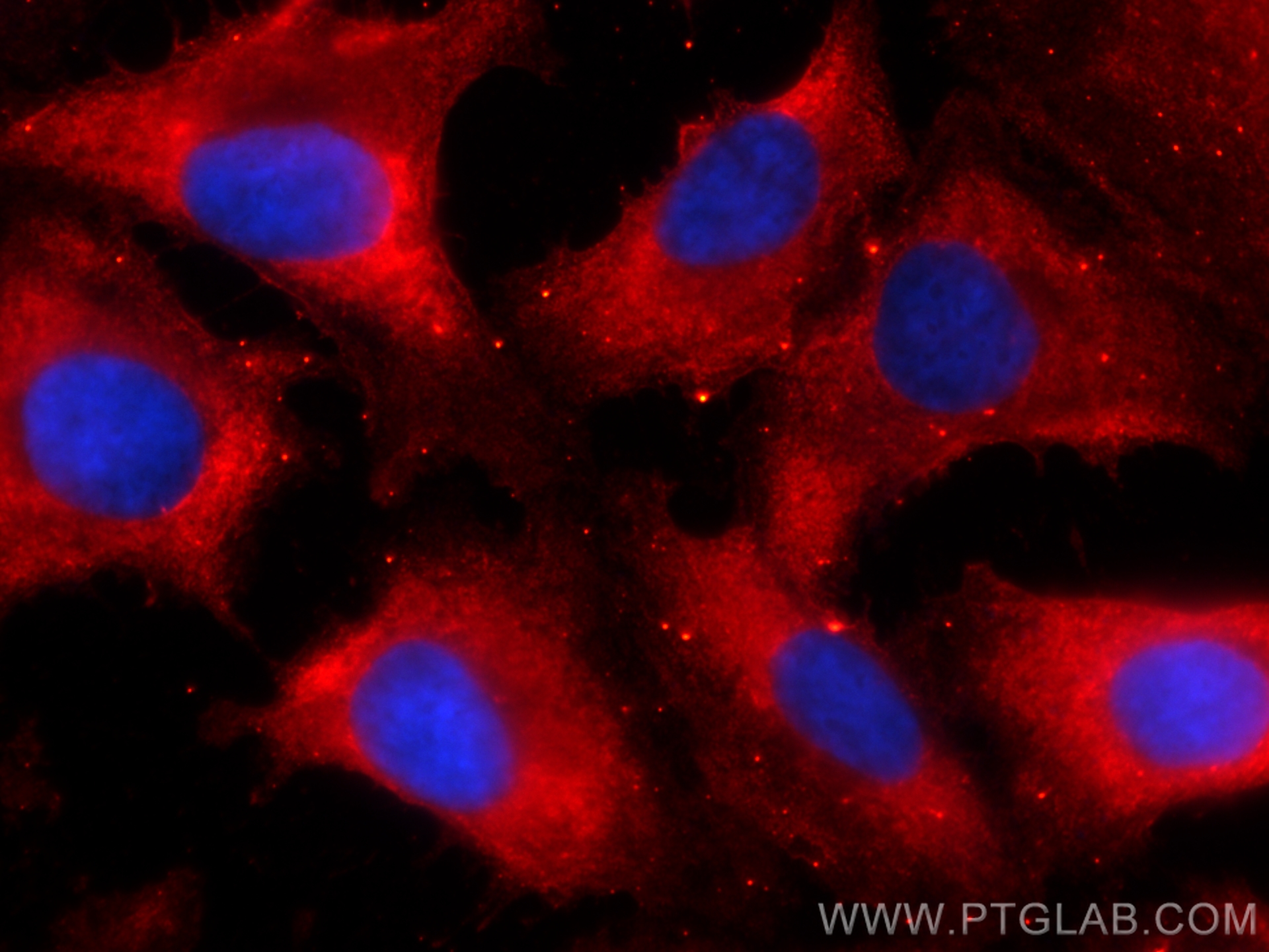 IF Staining of SKOV-3 using CL594-66557
