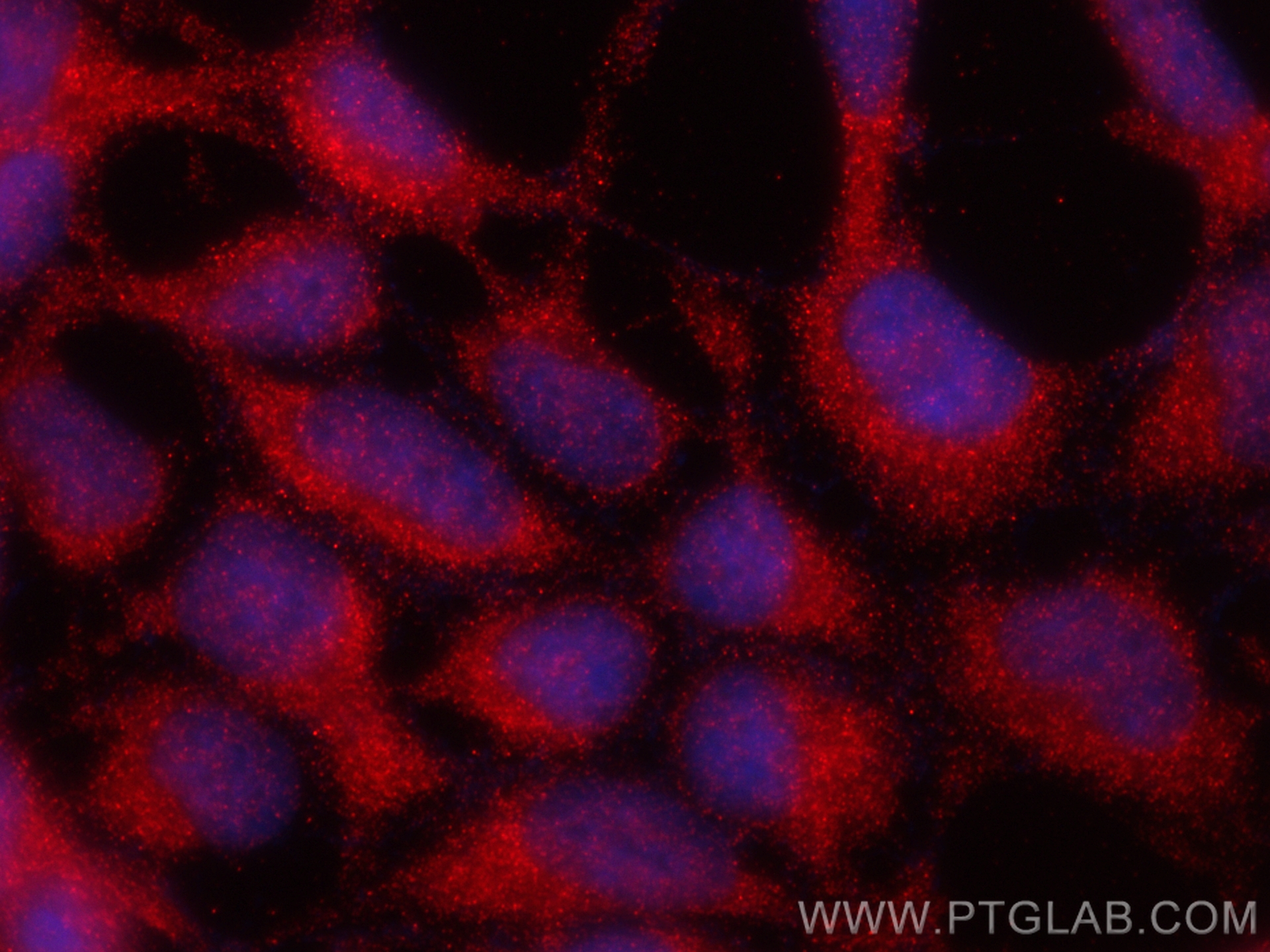 IF Staining of HEK-293 using 24578-1-AP