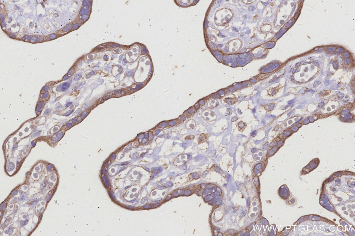 IHC staining of human placenta using 32316-1-AP