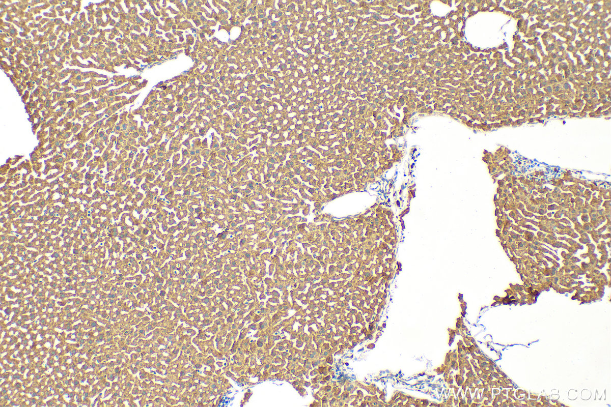 IHC staining of mouse liver using 82950-1-RR