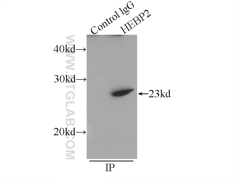 IP experiment of HEK-293 using 12706-1-AP